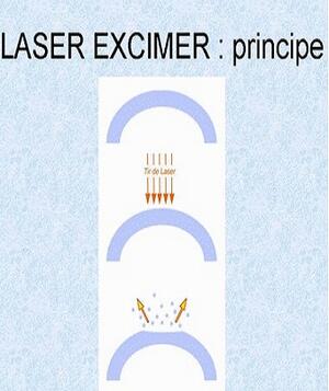 Hỗn hợp khí Laser Excimer